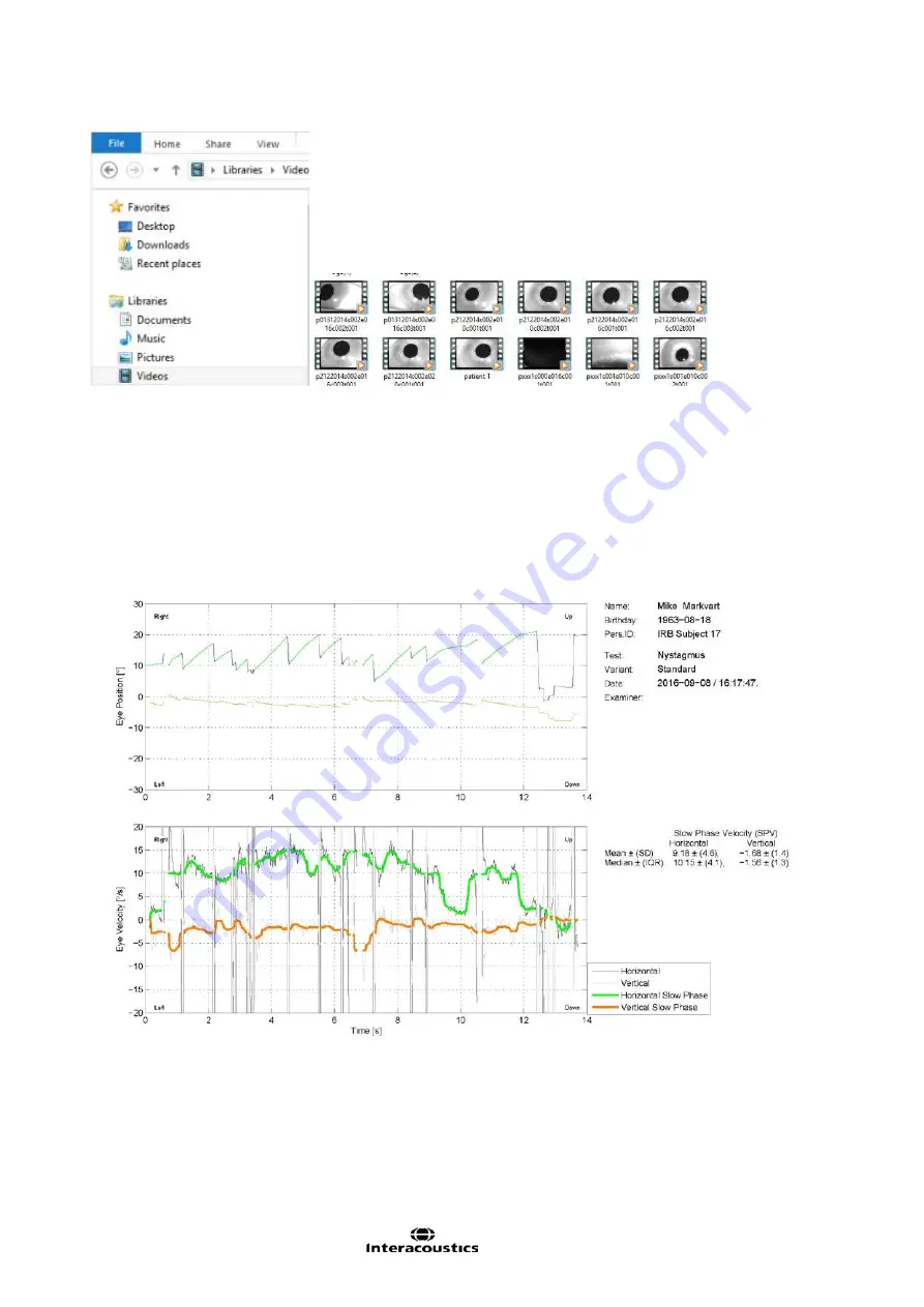 Interacoustics EyeSeeCam Instructions For Use Manual Download Page 147