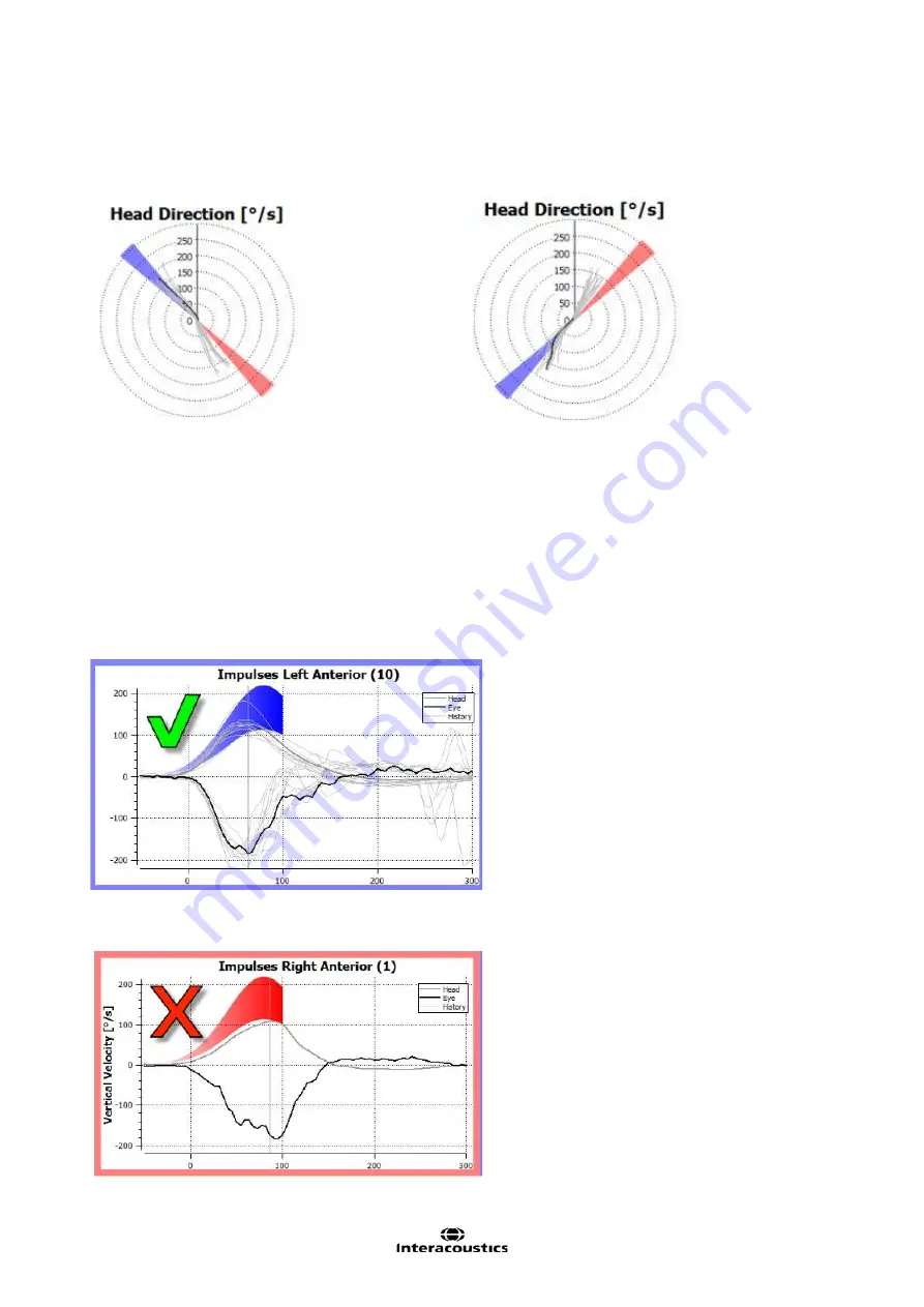 Interacoustics EyeSeeCam Instructions For Use Manual Download Page 189