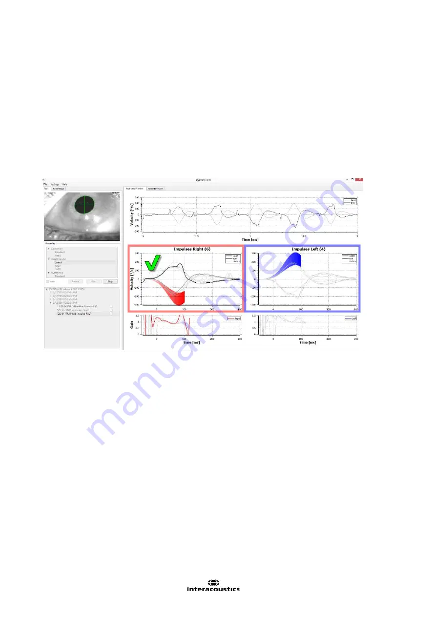 Interacoustics EyeSeeCam Instructions For Use Manual Download Page 235