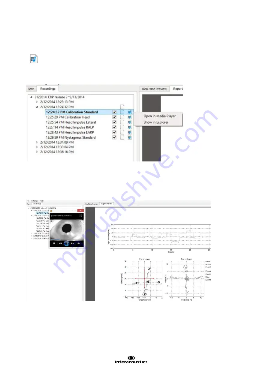 Interacoustics EyeSeeCam Instructions For Use Manual Download Page 246