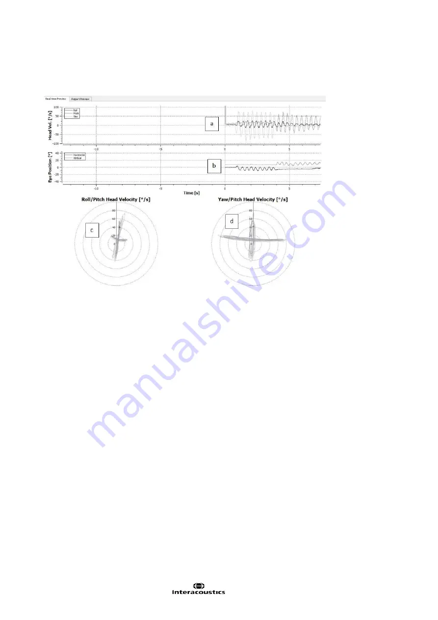 Interacoustics EyeSeeCam Instructions For Use Manual Download Page 281