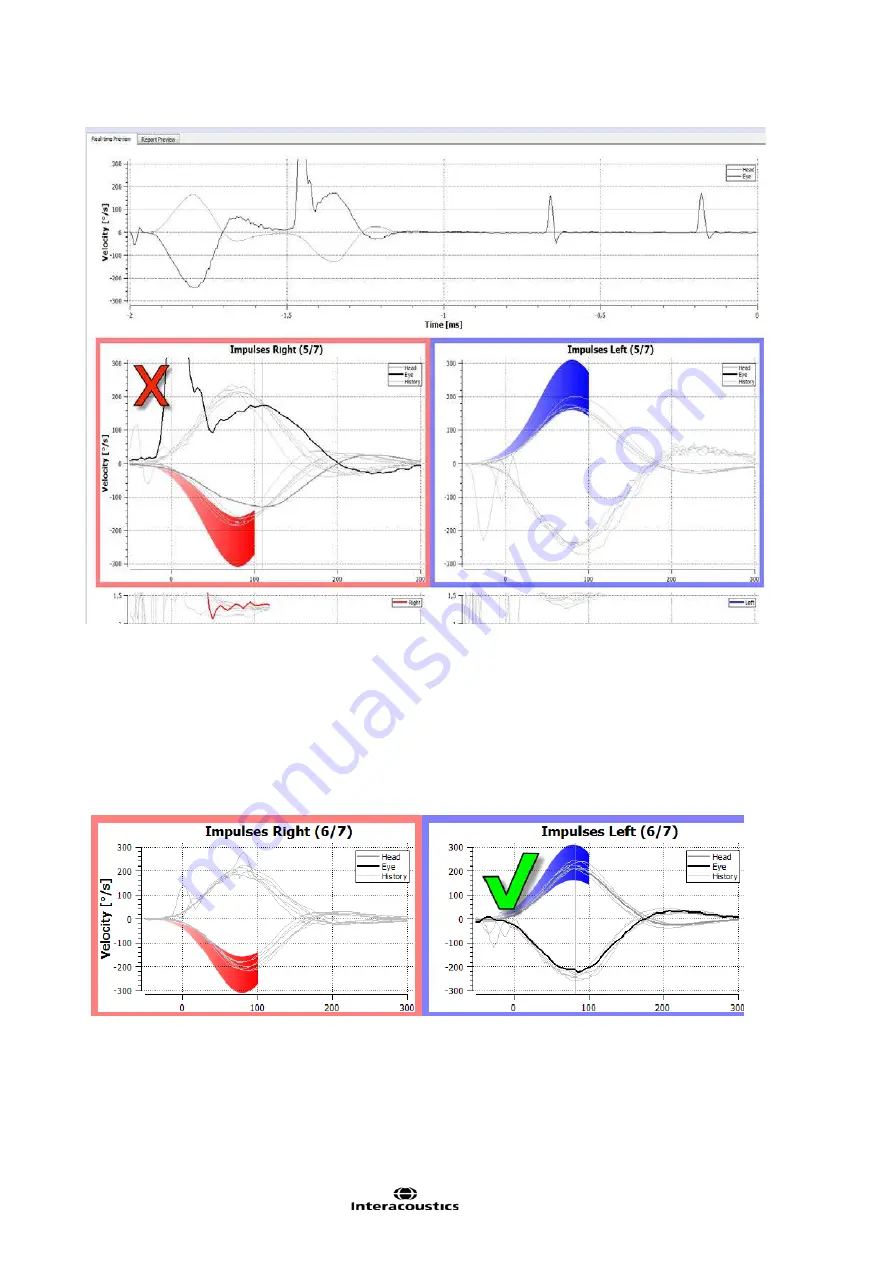 Interacoustics EyeSeeCam Instructions For Use Manual Download Page 285