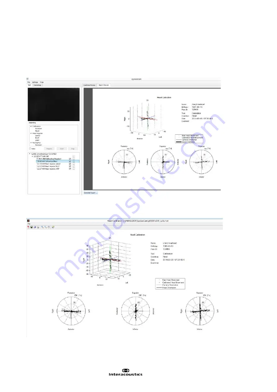 Interacoustics EyeSeeCam Instructions For Use Manual Download Page 293