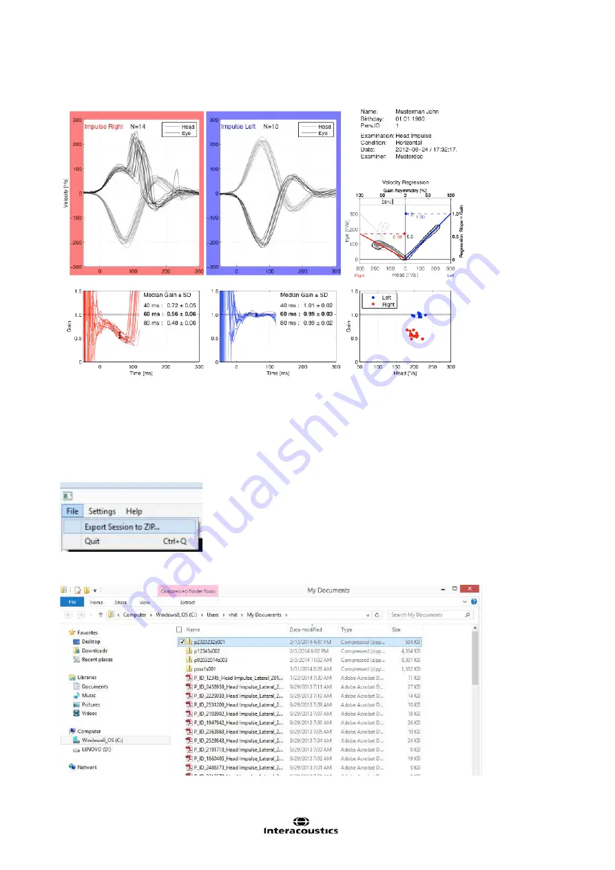 Interacoustics EyeSeeCam Instructions For Use Manual Download Page 350