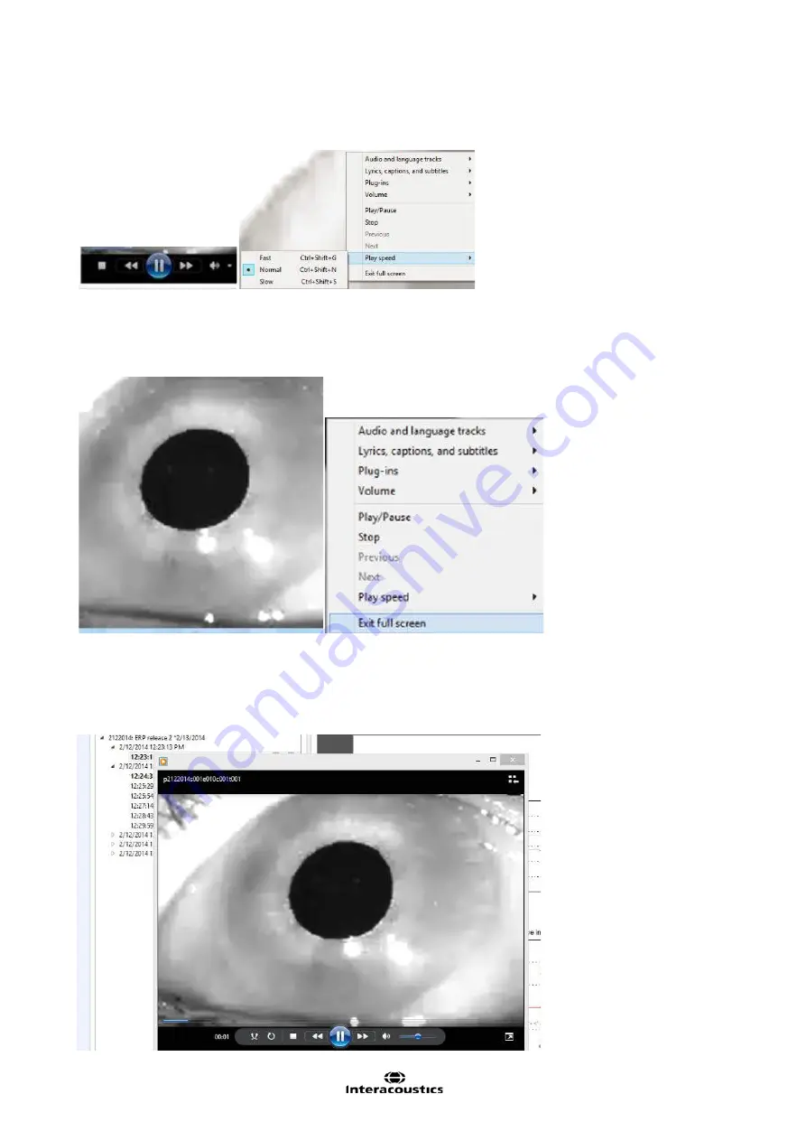 Interacoustics EyeSeeCam Instructions For Use Manual Download Page 398