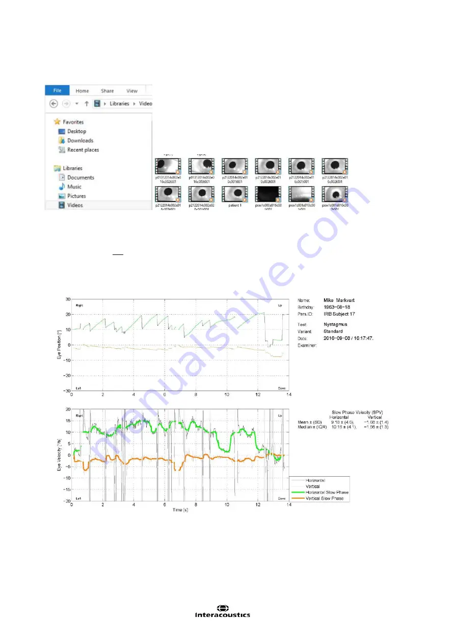 Interacoustics EyeSeeCam Instructions For Use Manual Download Page 399