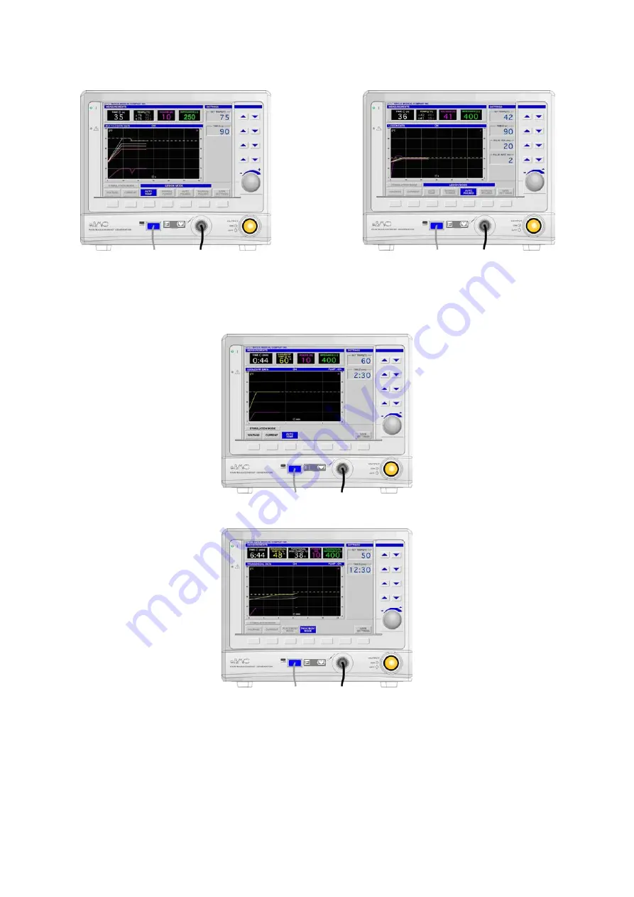 Kimberly-Clark Baylis PMG-115 User Manual Download Page 28