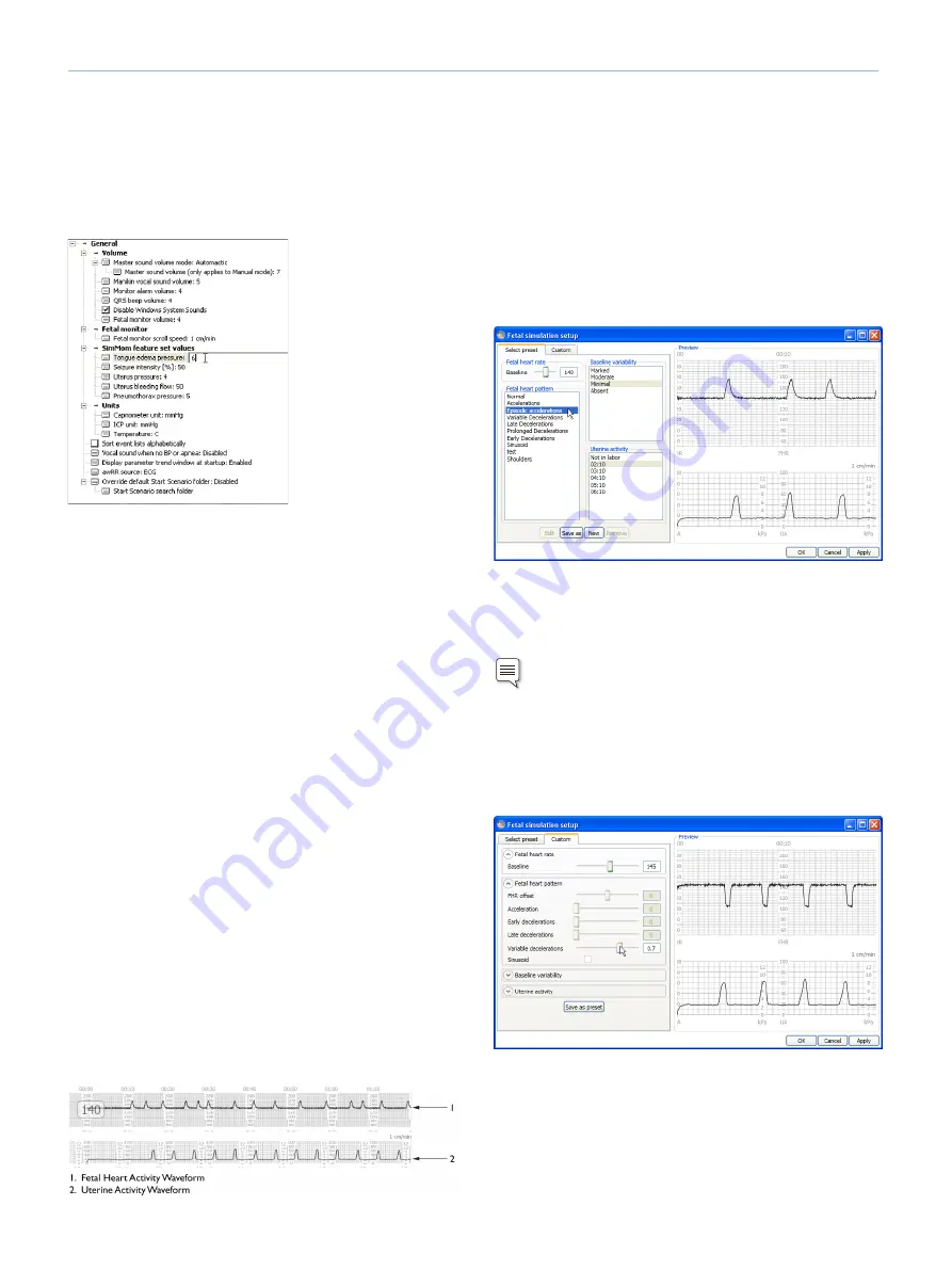 laerdal SimMom Directions For Use Manual Download Page 16