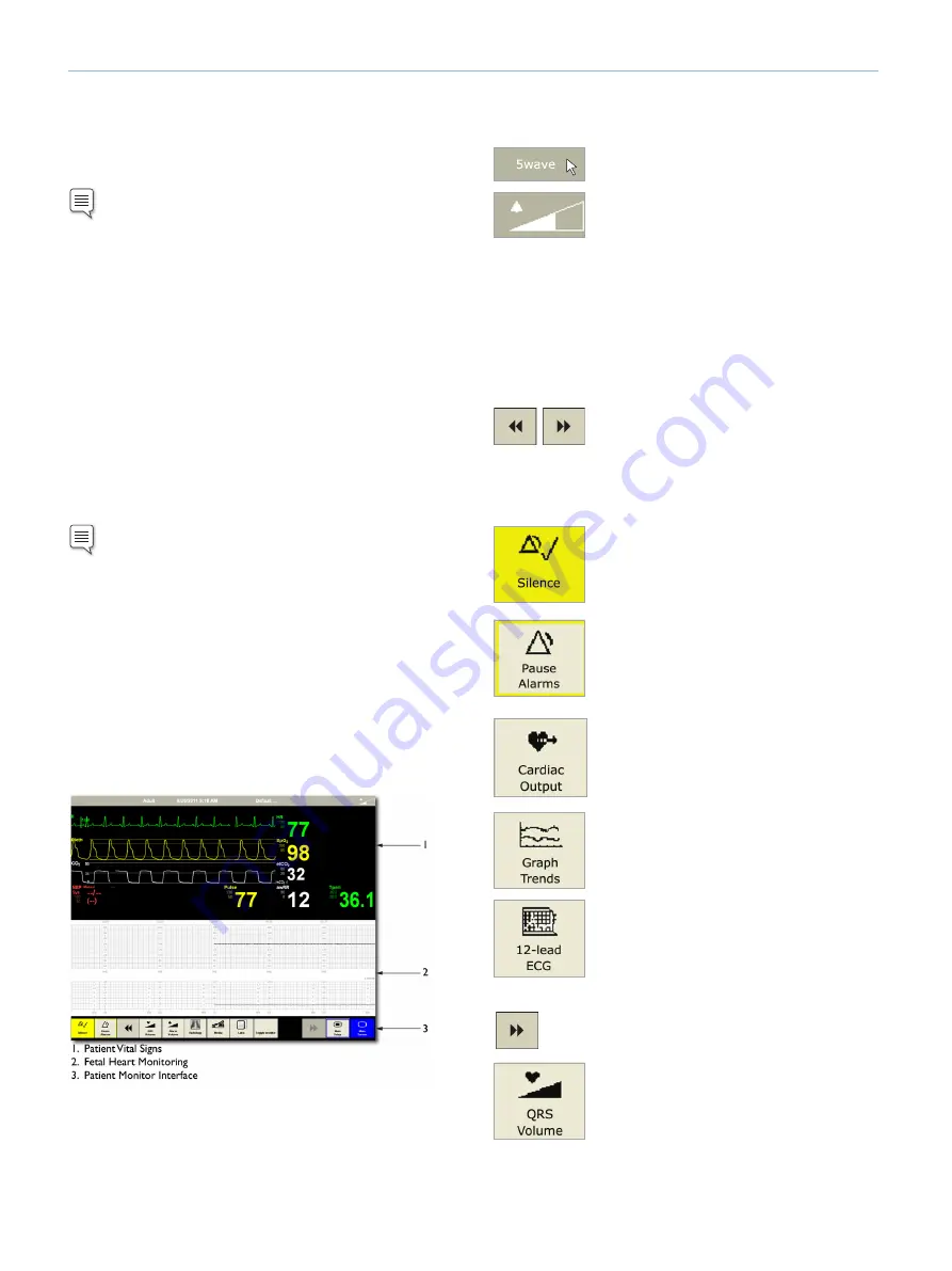 laerdal SimMom Directions For Use Manual Download Page 18