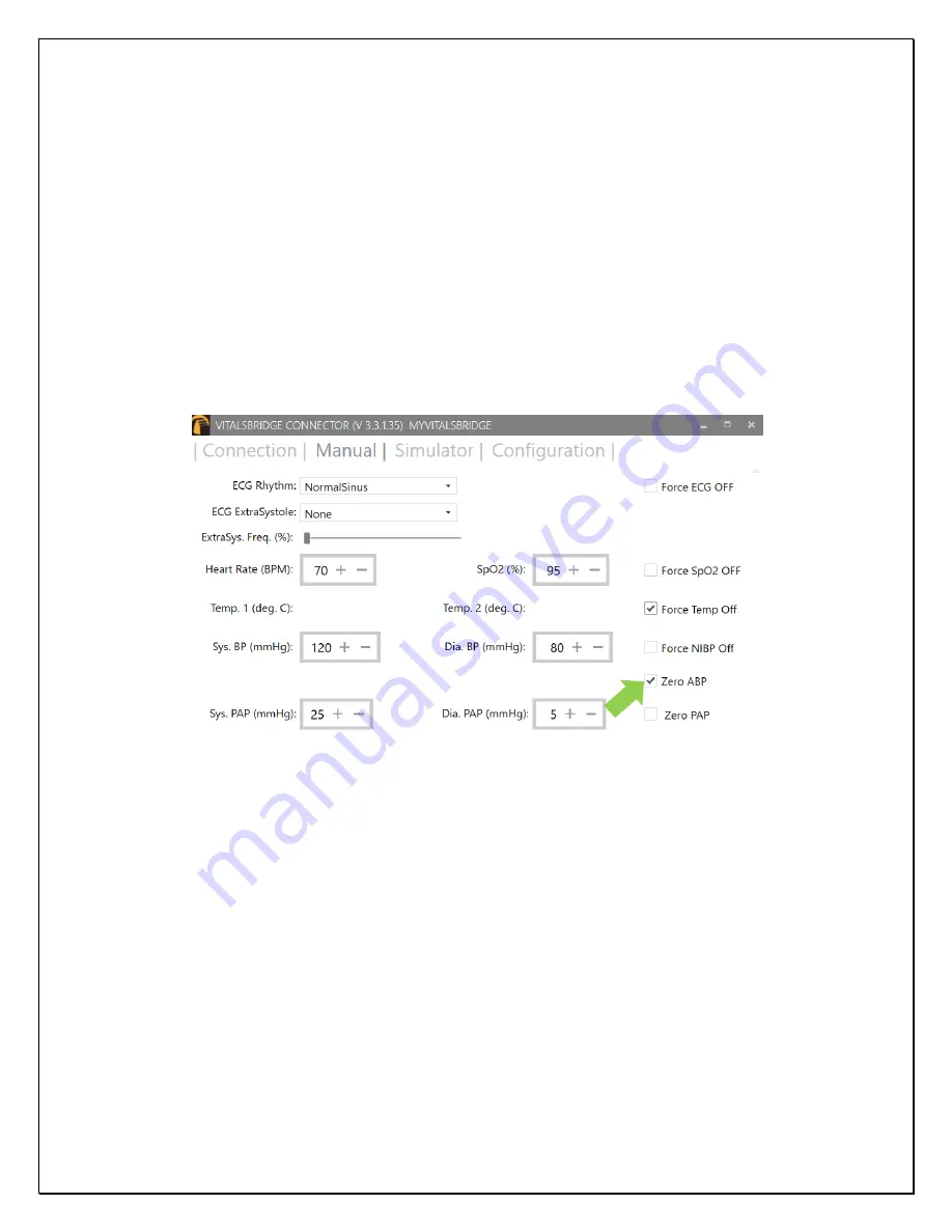 laerdal VB100 Directions For Use Manual Download Page 36