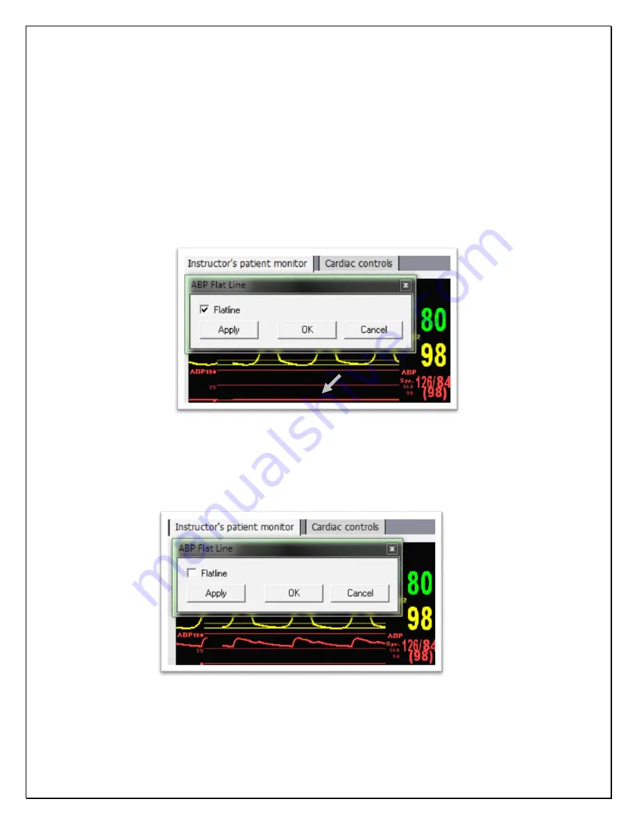 laerdal VitalsBridge Directions For Use Manual Download Page 33