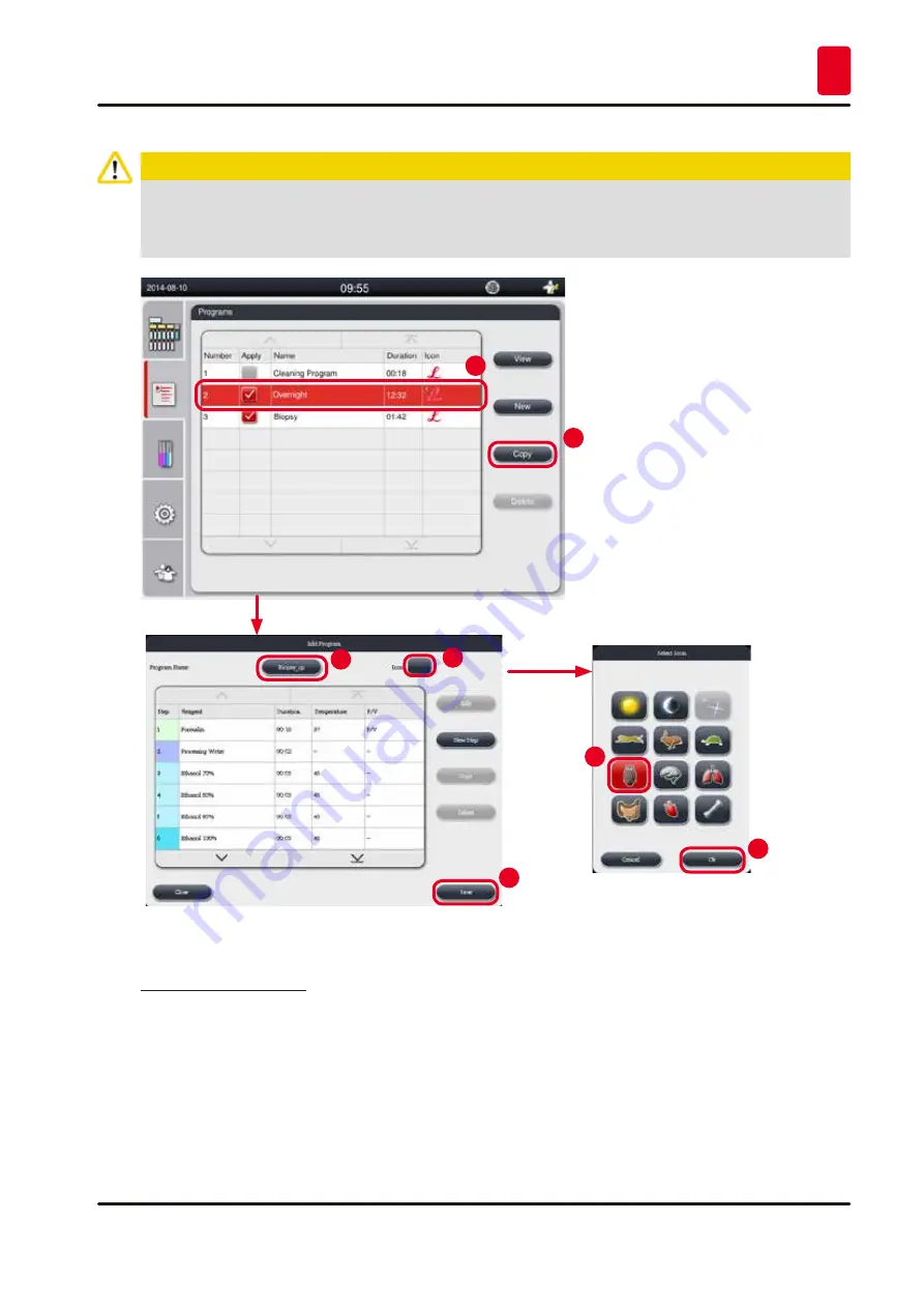 Leica BIOSYSTEMS 14 0493 80101 Instructions For Use Manual Download Page 67