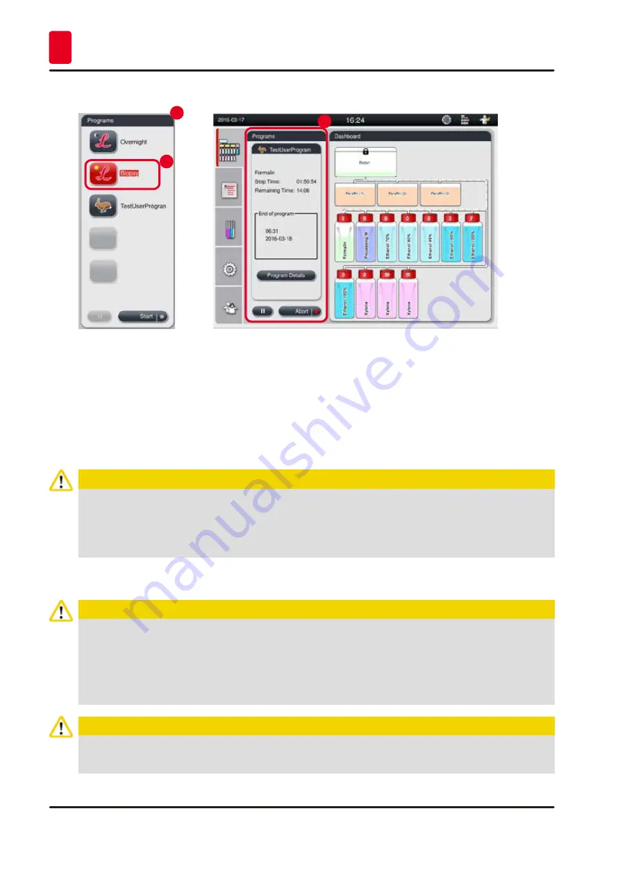 Leica BIOSYSTEMS 14 0493 80101 Скачать руководство пользователя страница 76