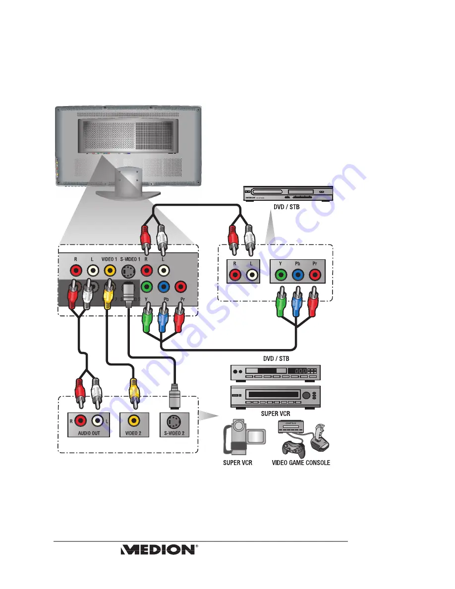 Medion MD 30227 User Manual Download Page 14