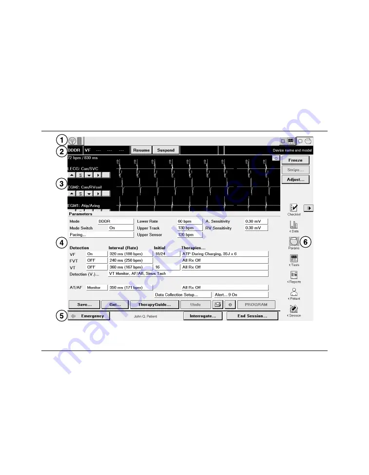 Medtronic PROTECTA XT DR D314DRG Clinician Manual Download Page 57