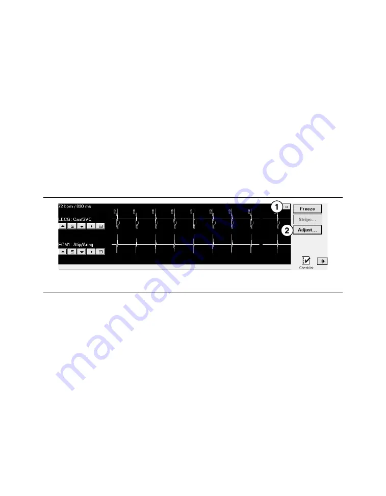 Medtronic PROTECTA XT DR D314DRG Скачать руководство пользователя страница 59