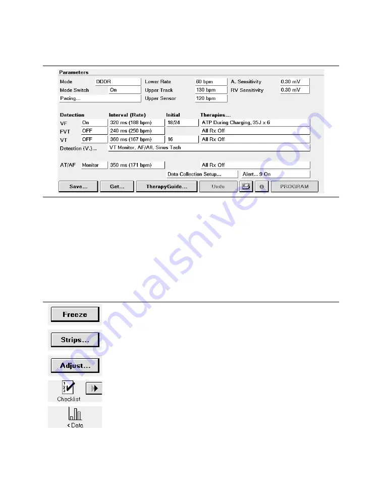 Medtronic PROTECTA XT DR D314DRG Скачать руководство пользователя страница 60