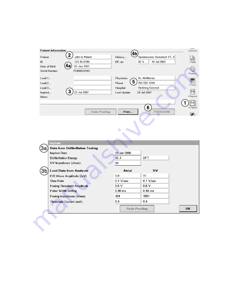 Medtronic PROTECTA XT DR D314DRG Скачать руководство пользователя страница 82