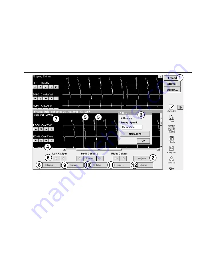 Medtronic PROTECTA XT DR D314DRG Скачать руководство пользователя страница 91