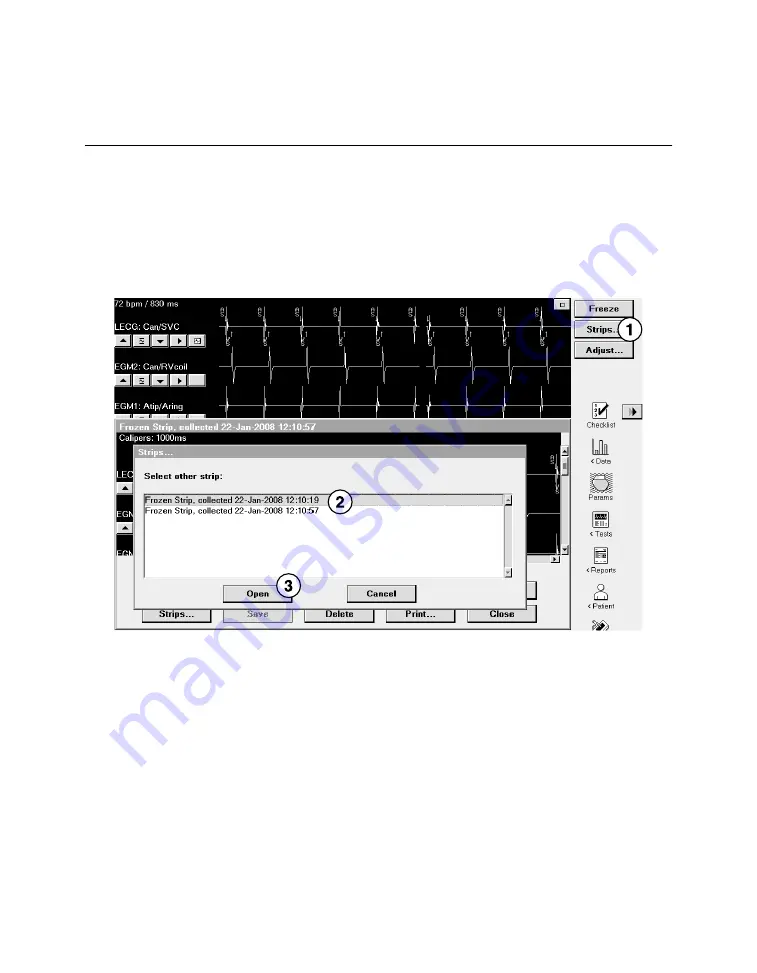 Medtronic PROTECTA XT DR D314DRG Clinician Manual Download Page 92