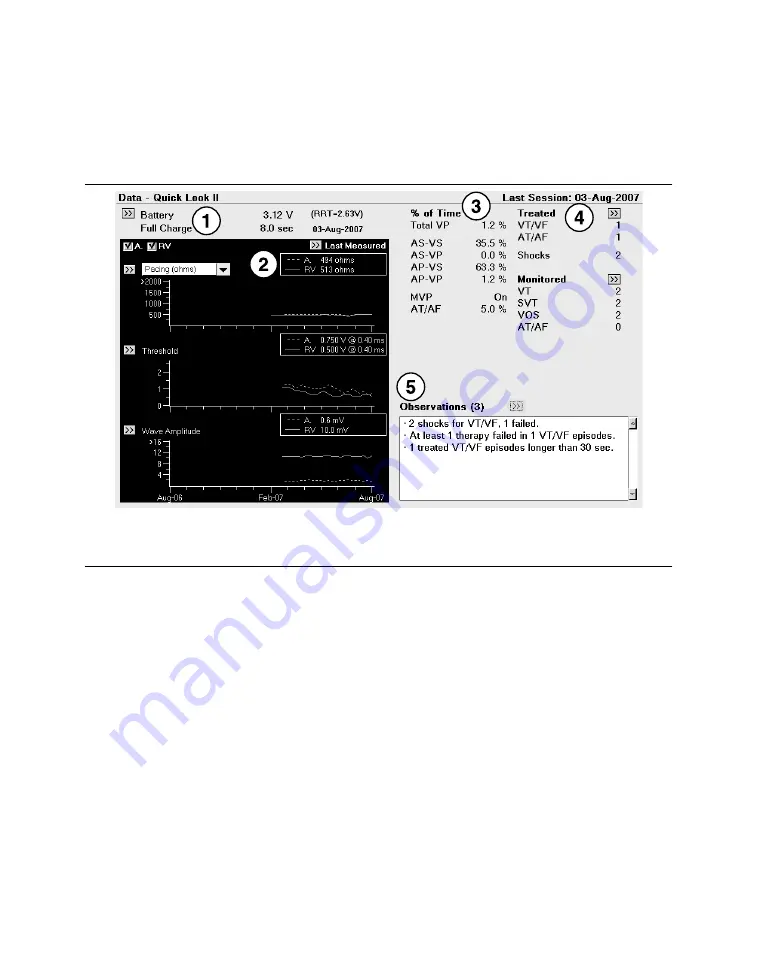 Medtronic PROTECTA XT DR D314DRG Clinician Manual Download Page 130