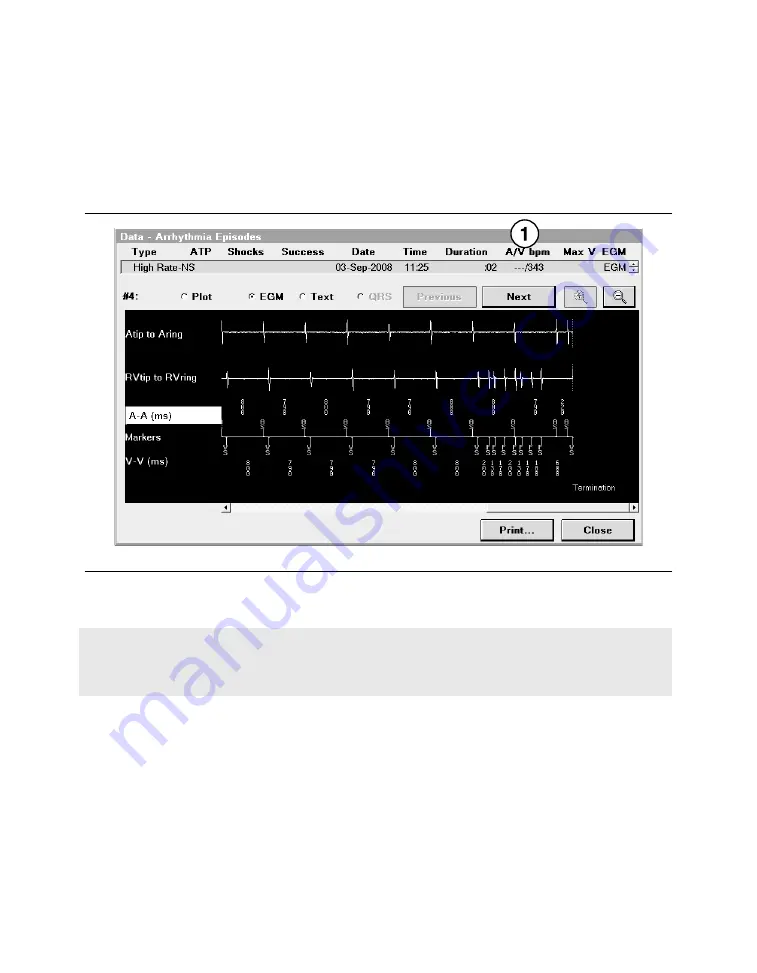 Medtronic PROTECTA XT DR D314DRG Clinician Manual Download Page 147