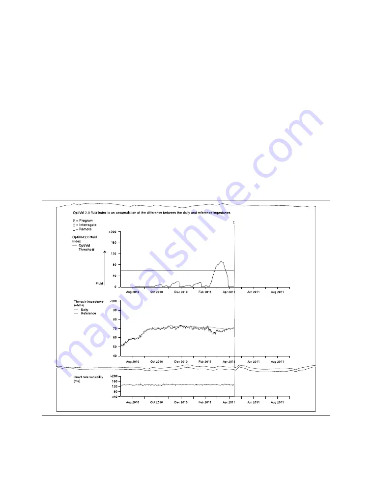 Medtronic PROTECTA XT DR D314DRG Clinician Manual Download Page 153