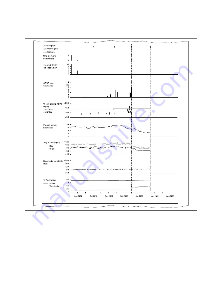 Medtronic PROTECTA XT DR D314DRG Clinician Manual Download Page 159