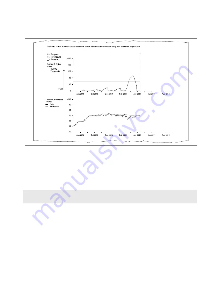 Medtronic PROTECTA XT DR D314DRG Скачать руководство пользователя страница 165