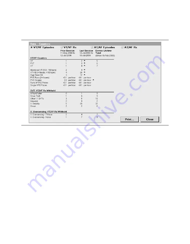 Medtronic PROTECTA XT DR D314DRG Скачать руководство пользователя страница 176