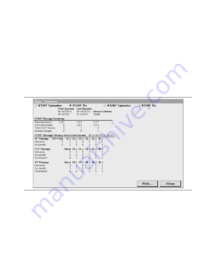 Medtronic PROTECTA XT DR D314DRG Скачать руководство пользователя страница 177