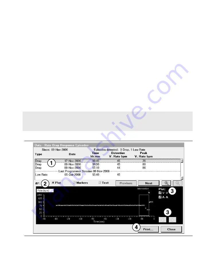 Medtronic PROTECTA XT DR D314DRG Clinician Manual Download Page 182