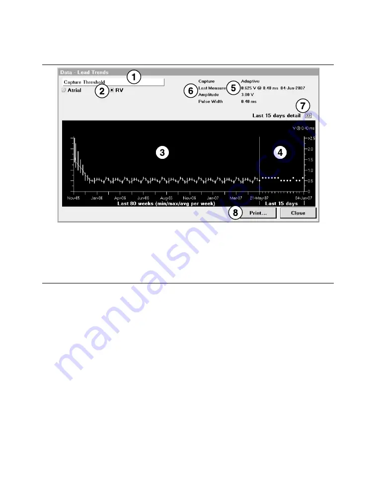 Medtronic PROTECTA XT DR D314DRG Clinician Manual Download Page 193