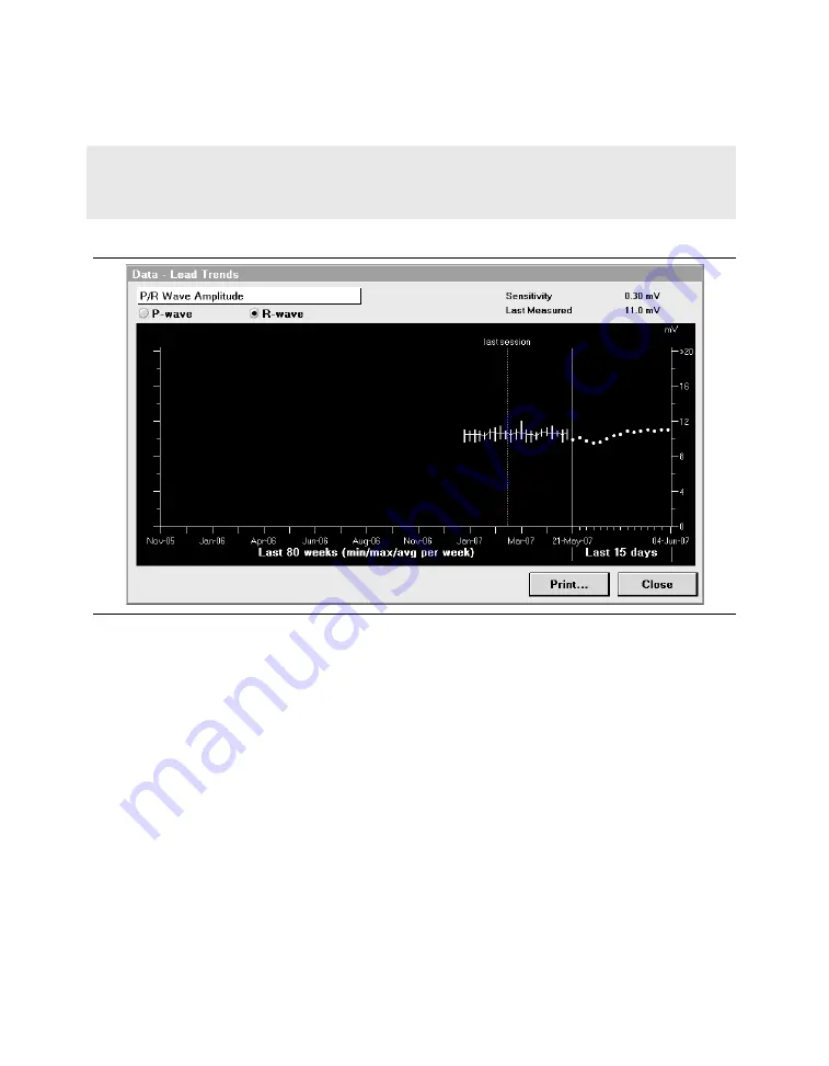 Medtronic PROTECTA XT DR D314DRG Скачать руководство пользователя страница 212