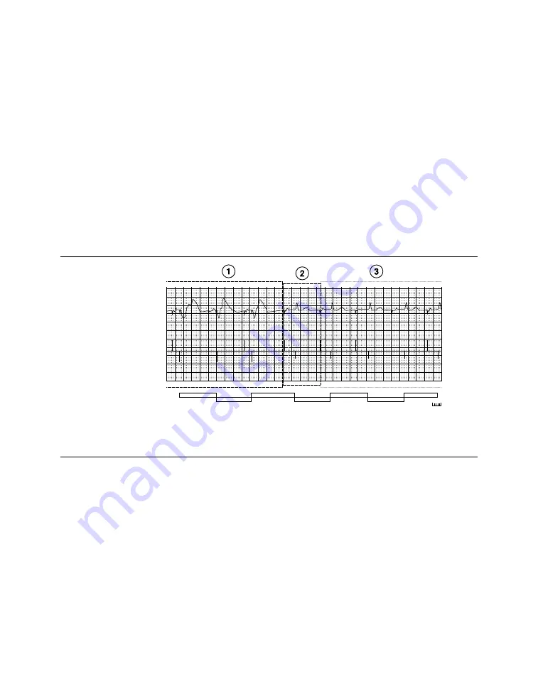 Medtronic PROTECTA XT DR D314DRG Скачать руководство пользователя страница 225