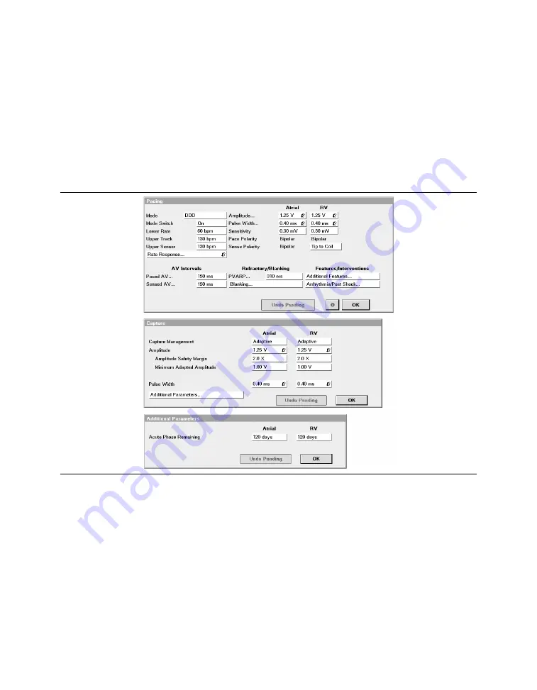 Medtronic PROTECTA XT DR D314DRG Clinician Manual Download Page 248