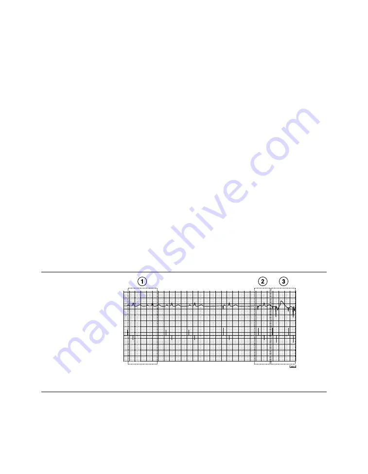 Medtronic PROTECTA XT DR D314DRG Скачать руководство пользователя страница 259