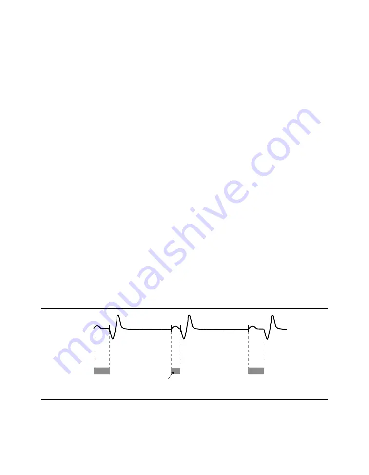 Medtronic PROTECTA XT DR D314DRG Скачать руководство пользователя страница 271