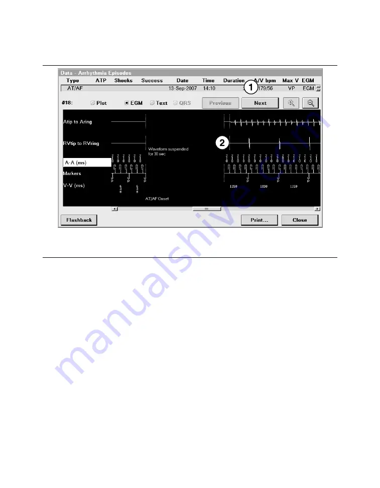 Medtronic PROTECTA XT DR D314DRG Скачать руководство пользователя страница 276