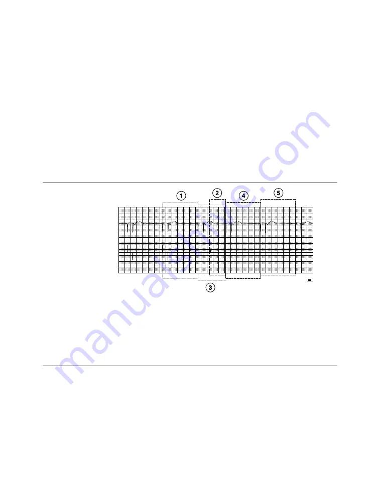 Medtronic PROTECTA XT DR D314DRG Скачать руководство пользователя страница 279