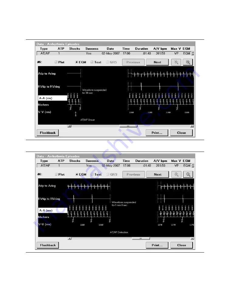 Medtronic PROTECTA XT DR D314DRG Скачать руководство пользователя страница 301