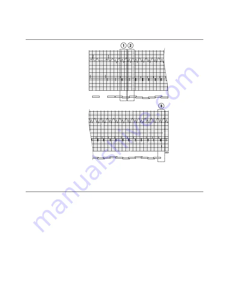 Medtronic PROTECTA XT DR D314DRG Скачать руководство пользователя страница 308