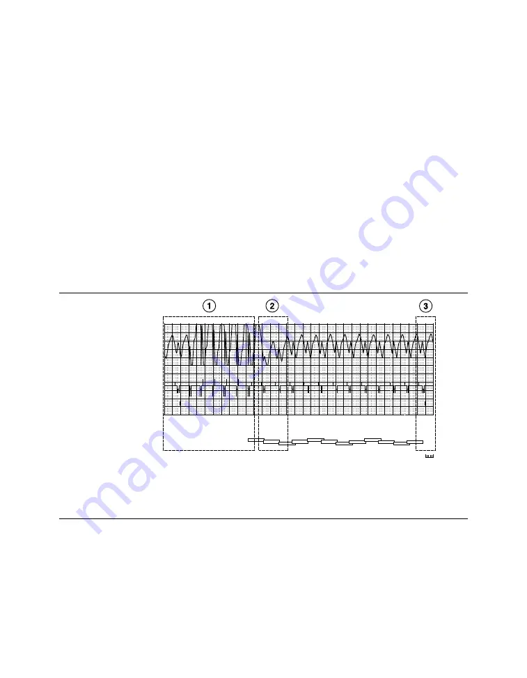 Medtronic PROTECTA XT DR D314DRG Clinician Manual Download Page 312