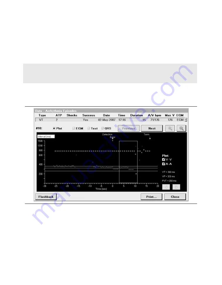 Medtronic PROTECTA XT DR D314DRG Clinician Manual Download Page 317