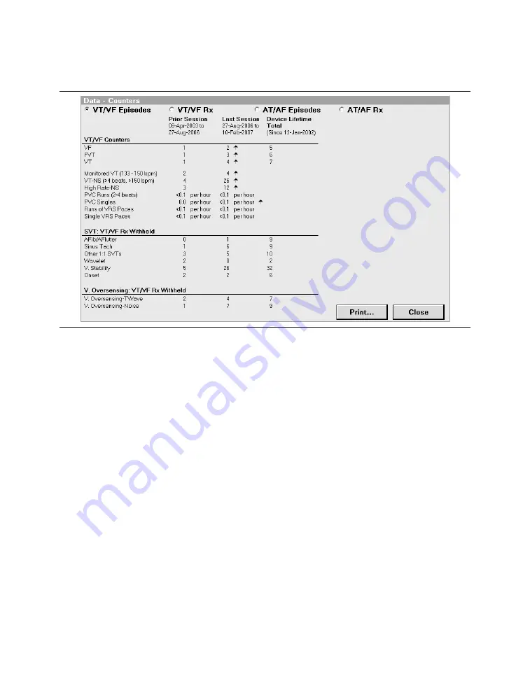 Medtronic PROTECTA XT DR D314DRG Скачать руководство пользователя страница 321