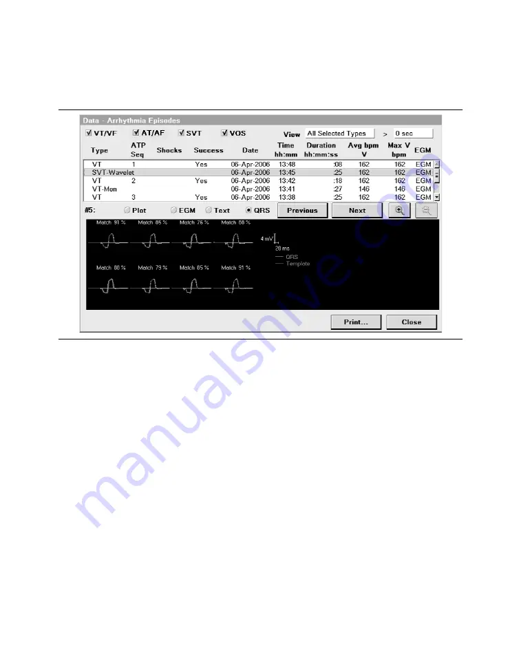 Medtronic PROTECTA XT DR D314DRG Скачать руководство пользователя страница 333