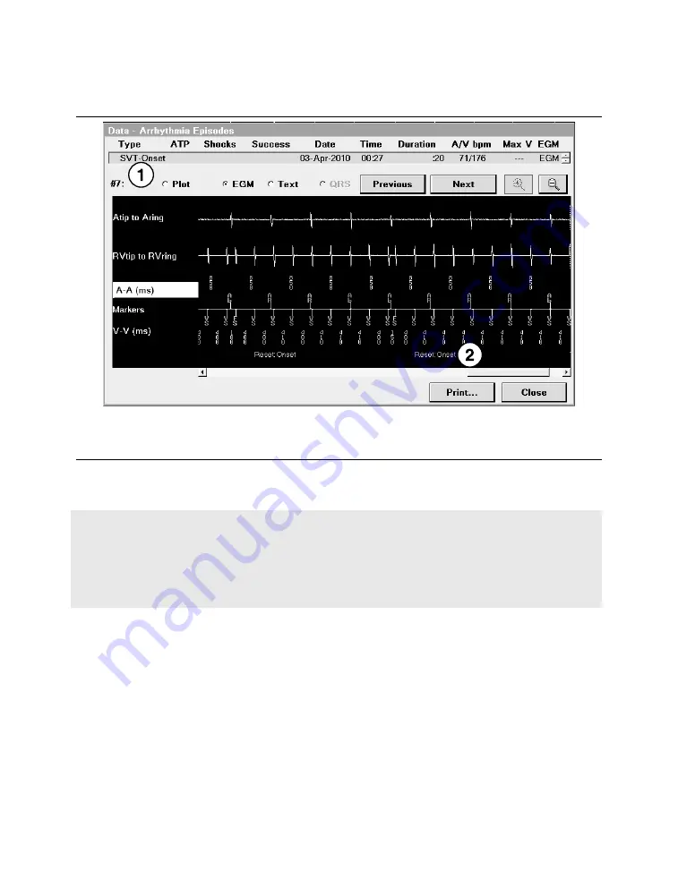 Medtronic PROTECTA XT DR D314DRG Скачать руководство пользователя страница 339