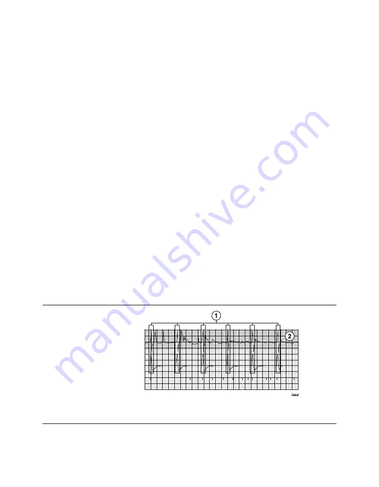 Medtronic PROTECTA XT DR D314DRG Clinician Manual Download Page 345