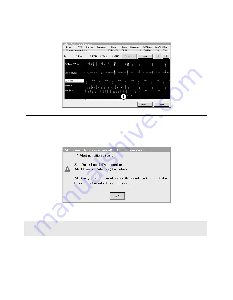 Medtronic PROTECTA XT DR D314DRG Скачать руководство пользователя страница 349