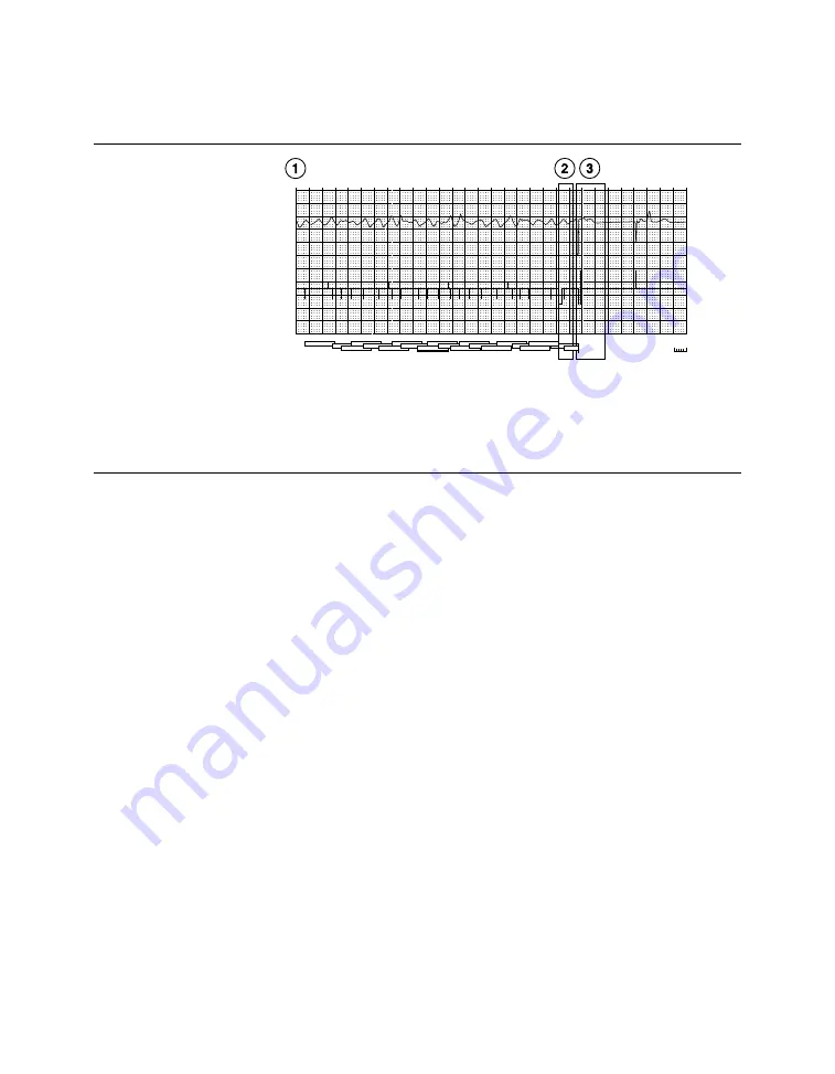 Medtronic PROTECTA XT DR D314DRG Скачать руководство пользователя страница 362